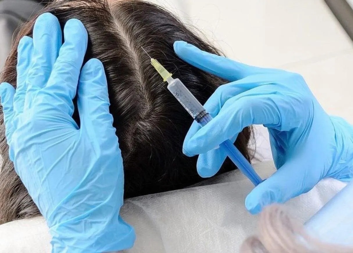 Hair transplant Turkey: The Smart Choice for Hair Recovery